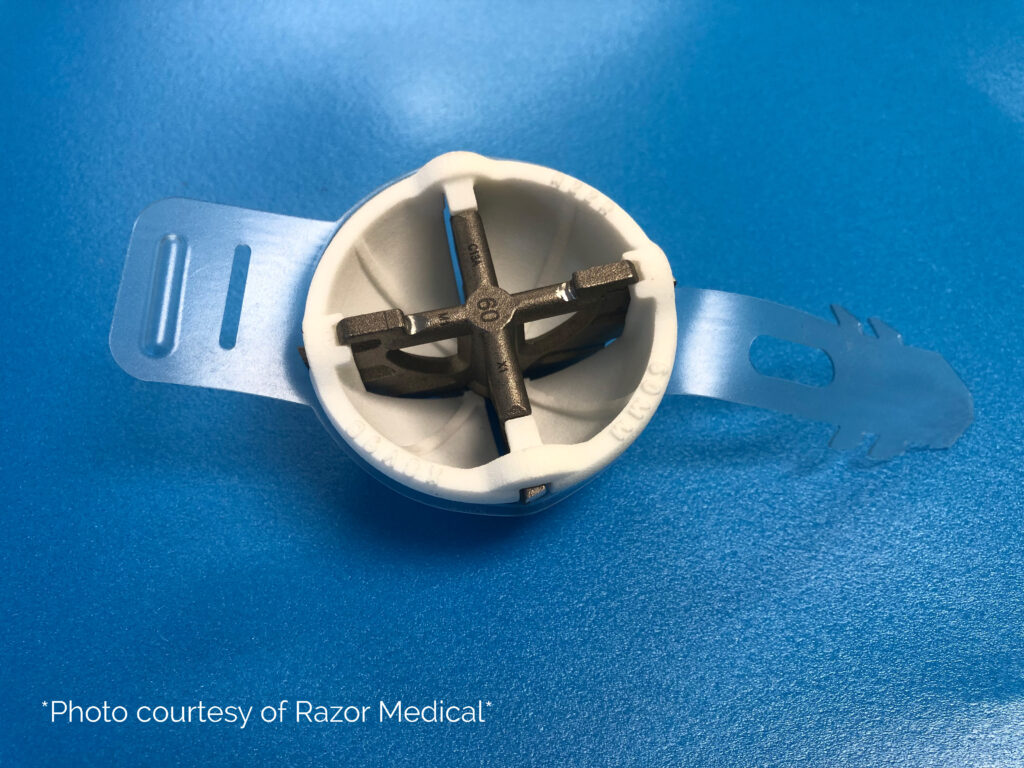 Case Study The Acetabular Reamer Project Janco Inc